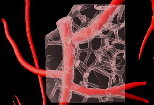Virtual depiction of part of a 3D-bioprinted model of cardiac vasculature made with collagen bioink