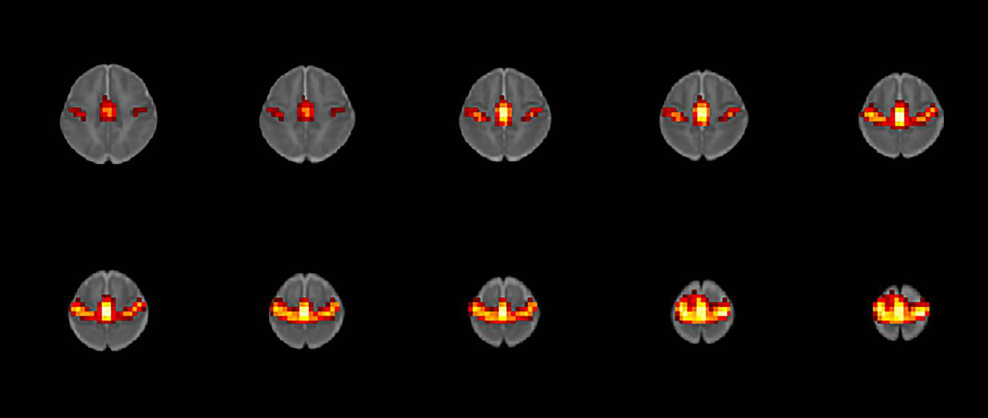 fMRI of infants