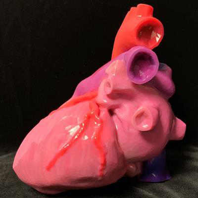 An individually tailored, multicolor 3D-printed heart