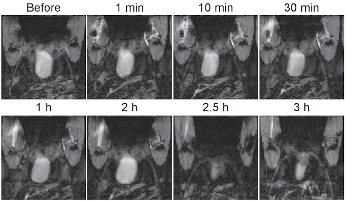 MR images of a mouse before and after an intramuscular injection of the probe show that with the protective molecular structure around the probe, it maintained its contrast for up to two hours