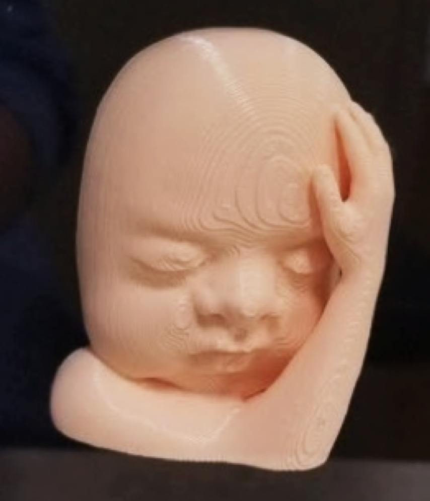 3D-printed model of a fetus