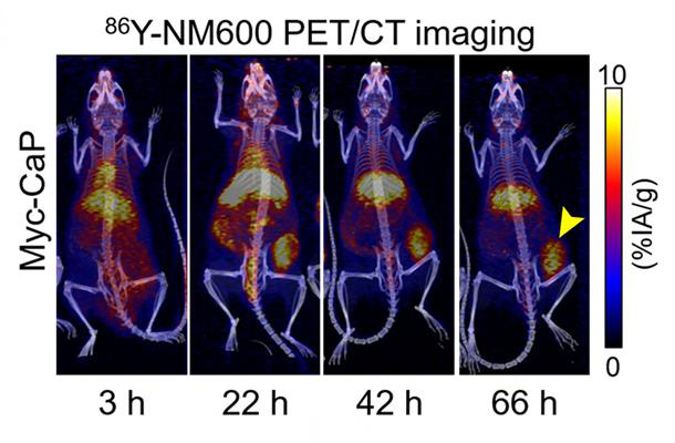 PET/CT image shows uptake and retention of 86Y-NM600 (imaging agent) in immunocompetent mice bearing prostate tumors