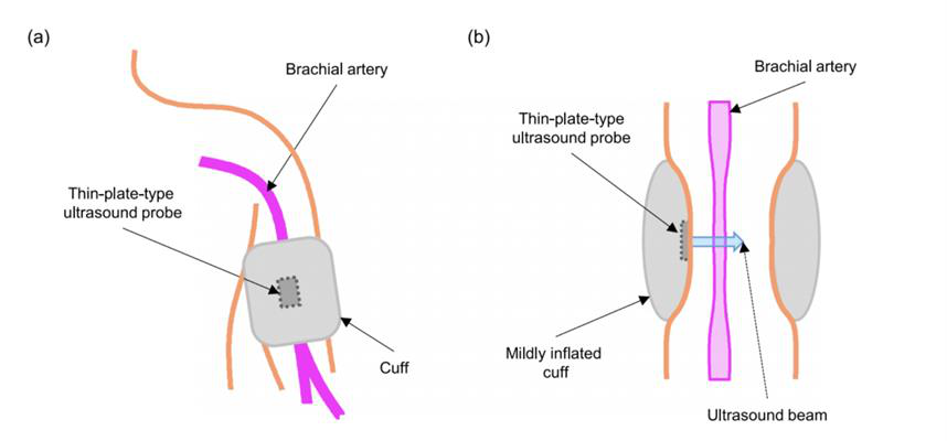 Schematic illustration of the cuff and ultrasound probe wrapped around the upper arm and positioned over the brachial artery.