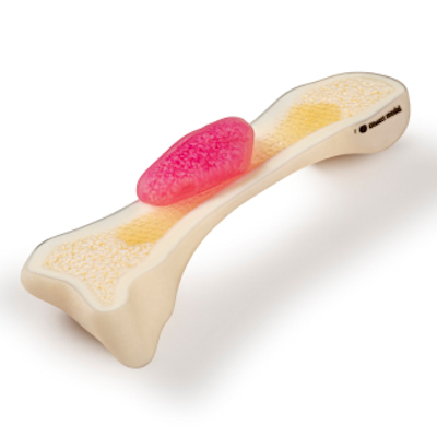 The Stratasys J750 3D printer produces accurate models of patient bones down to the voxel level, including marrow