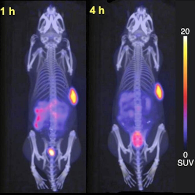 Representative maximum-intensity projection PET/CT images of AR42J tumor-bearing female Balb/c nude mice following injection of Cu-64 CuSarTATE