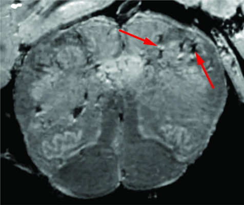 High-resolution MRI scan of a patient
