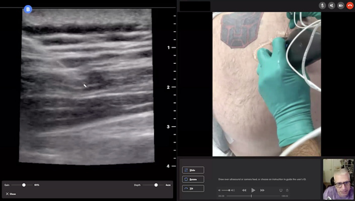 Dr. Peter Weimersheimer supervises an ultrasound-guided nerve block remotely