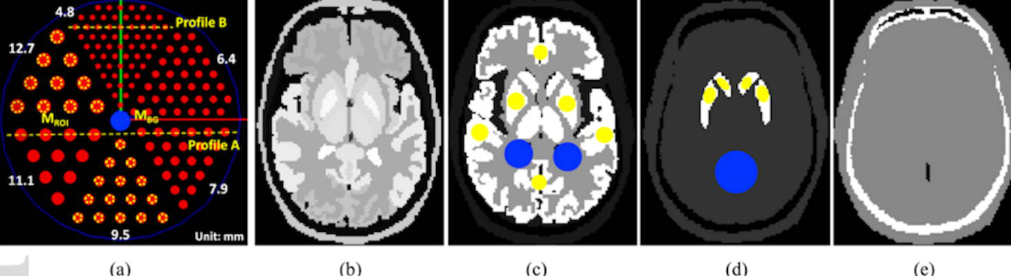 The 3D activity map (left) and the 3D reconstructed images for the brain perfusion study using the three configurations of the conventional scanner and a proposed SPECT eight-ring CZT scanner in AS-3 and AS-5 acquisition modes with 100 iterations and post-processed using a 3D Gaussian filter with a sigma of 1 pixel