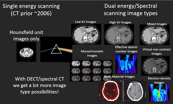 Many more image types are available with dual-energy than with single-energy CT