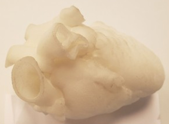 3D printed infant heart model manufactured by Shapeways for Armor Bionics