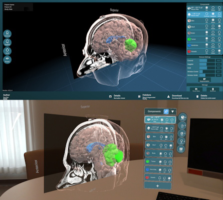 3D models generated with automatic segmentation and shown through an embedded 3D viewer in a web-based interface and an AR-head-mounted display