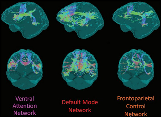 Example of structural connectivity of the three analyzed distributed cortical networks from one participant in the DIAN cohort