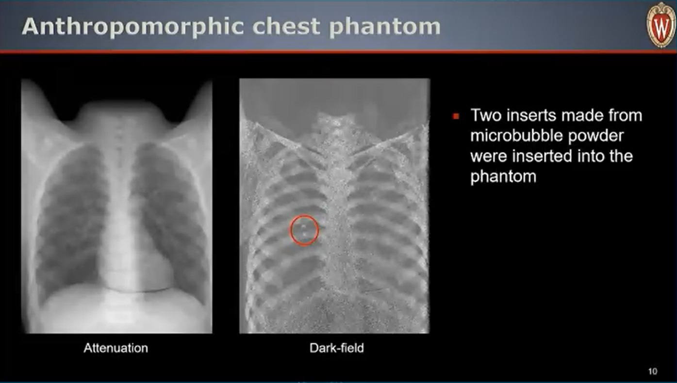 phantom x-ray image