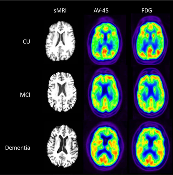 Visual comparison of sMRI