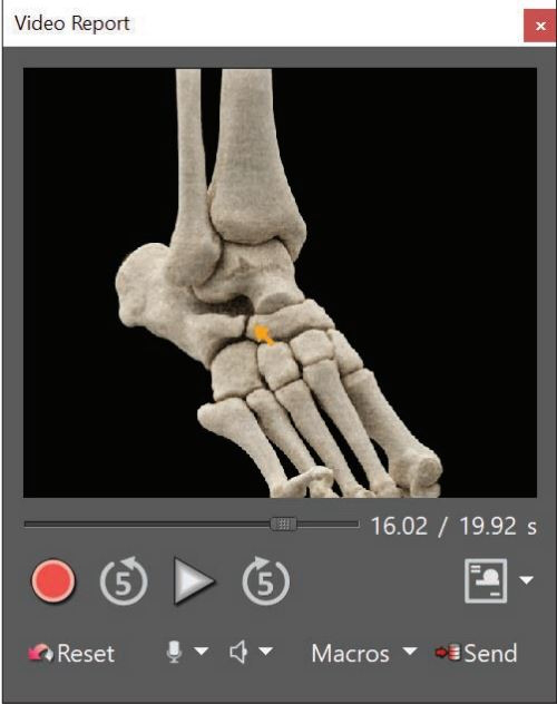 A team at New York University led the development of radiology video reports to help patients better understand imaging results