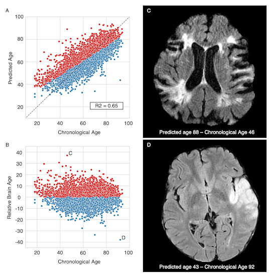 Brain age prediction performances and relative brain age.