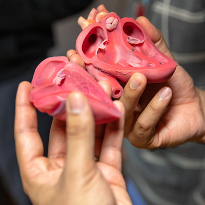 Sample of a 3D-printed model produced for surgical planning by Tampa General Hospital and USF Health Morsani College of Medicine