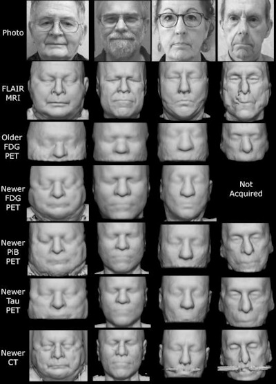Example face reconstructions from PET and CT
