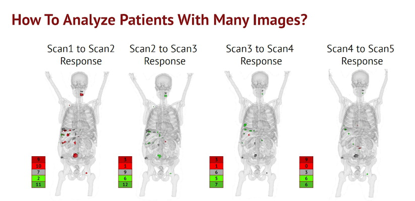 Representative PET/CT images of a patient used in developing the AI model