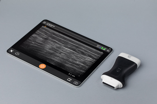 Clarius L7 HD3 wireless ultrasound scanner