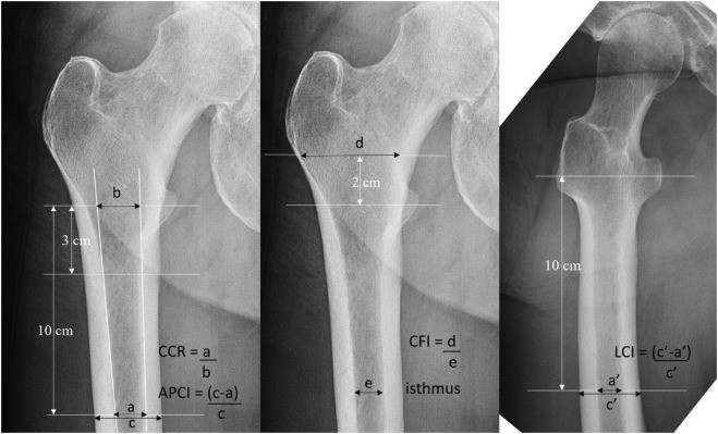 Measuring methods of each x-ray image of the hip