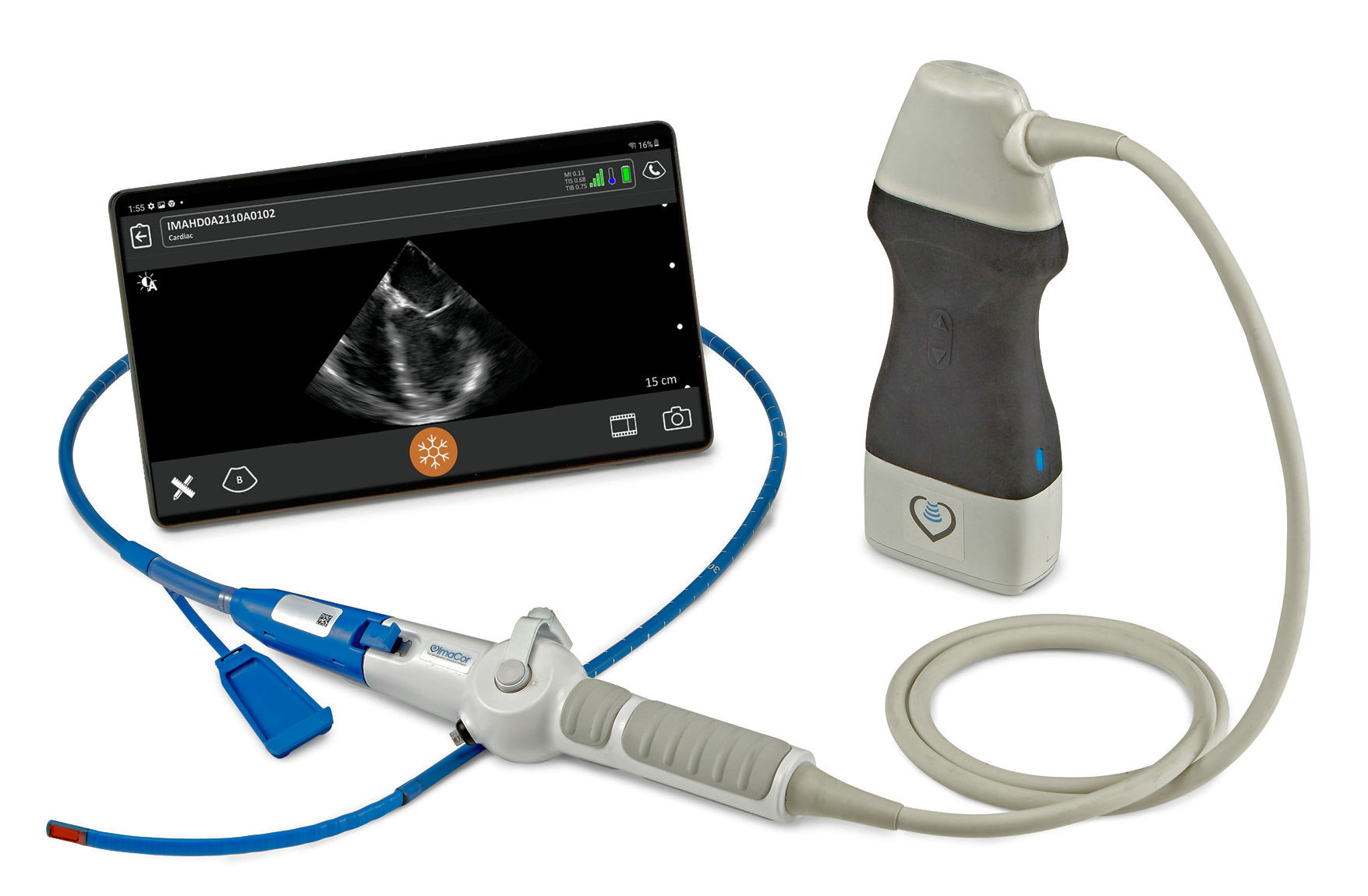  The Zura handheld hemodynamic ultrasound scanner 