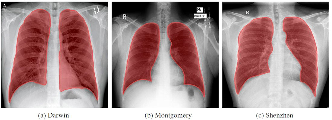 Sample images from each of the three databases used to train the lung segmentation algorithms