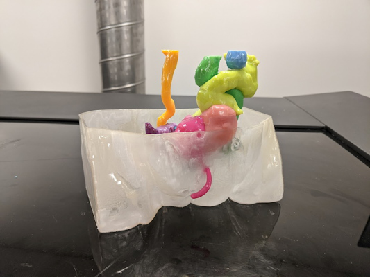 A 3D printed model shows the genitourinary system of a 13 month old girl