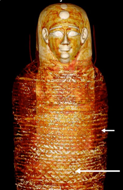 3D CT image of the front of the head and torso of mummy shows the head mask and the most outer bandages arranged transversely