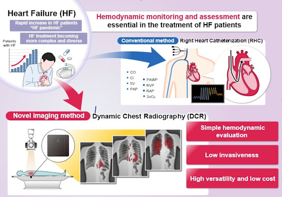 graphical abstract of hemodynamic assessment is essential for heart failure monitoring and assessment