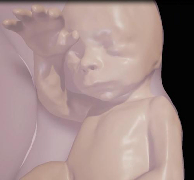 Close-up of fetus at 26 weeks