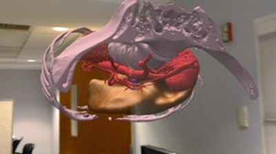 Hologram of CT abdomen/pelvis