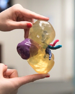 3D-printed kidney