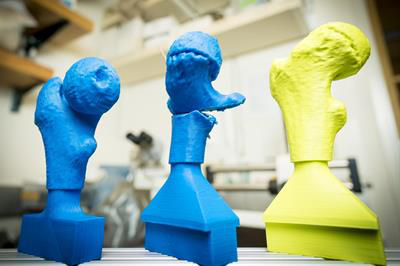 3D printing can shorten surgical fluoroscopy time in pediatric hip surgeries