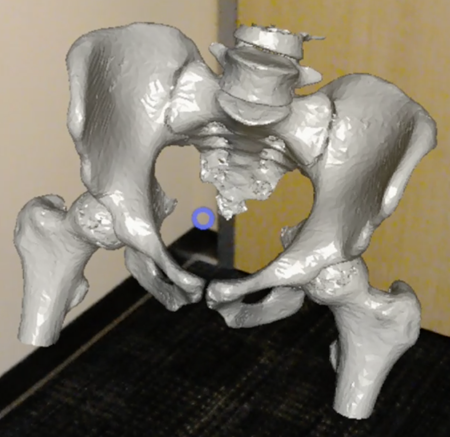 3D CT image of pelvis