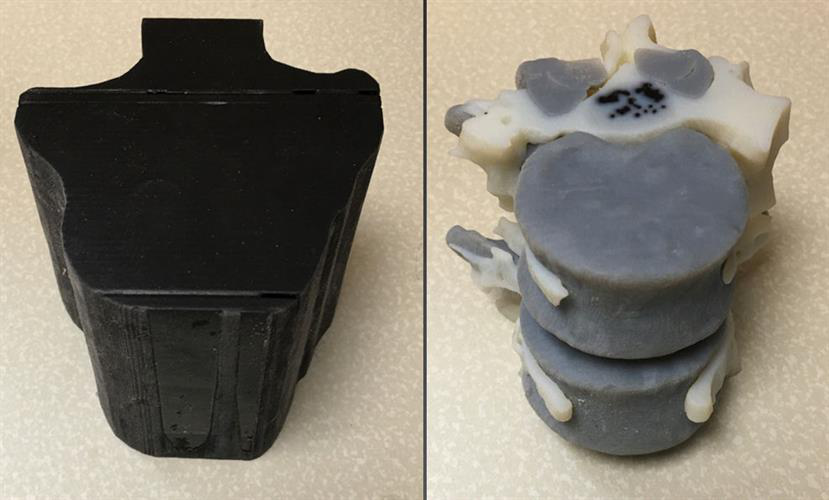 3D-printed spinal module and internal structure of the model