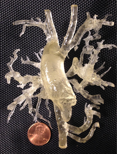 3D-printed model of a heart with tetralogy of Fallot