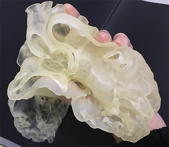 Demonstration of the flexibility of the 3D-printed heart