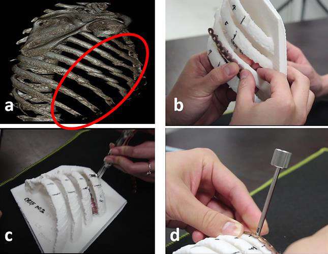 3D reconstruction of chest CT scans and model of 3D-printed rib