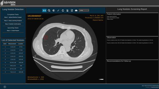 Deep learning model to identify lung nodules on chest CT