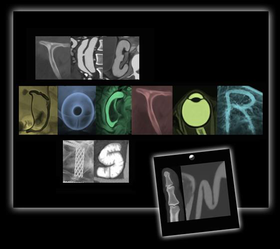 X-ray images spelling: The doctor is in