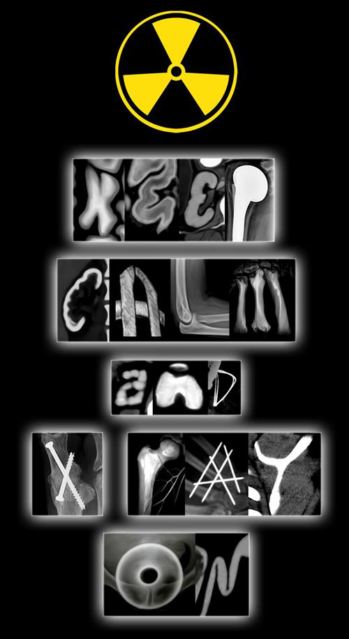 X-ray images spelling: Keep calm and x-ray on