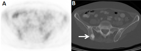 Axial FDG-PET and CT component