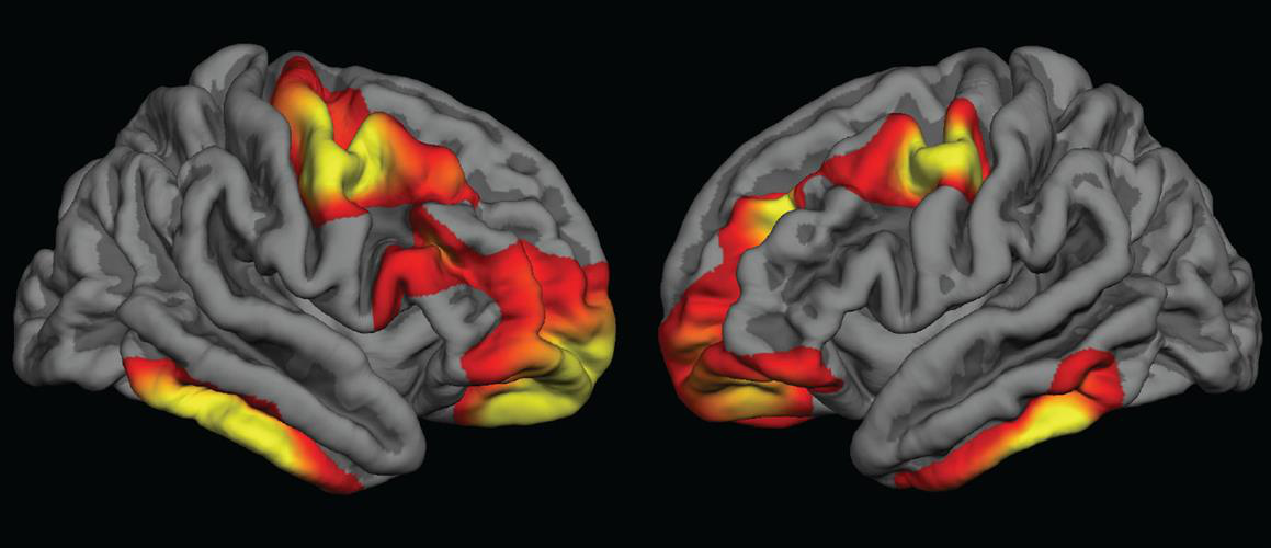 Colored areas indicate regions of the cerebral cortex that are significantly thicker in children who were exposed to folic acid fortification during pregnancy
