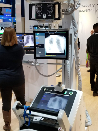 The Optima XR240amx mobile x-ray system