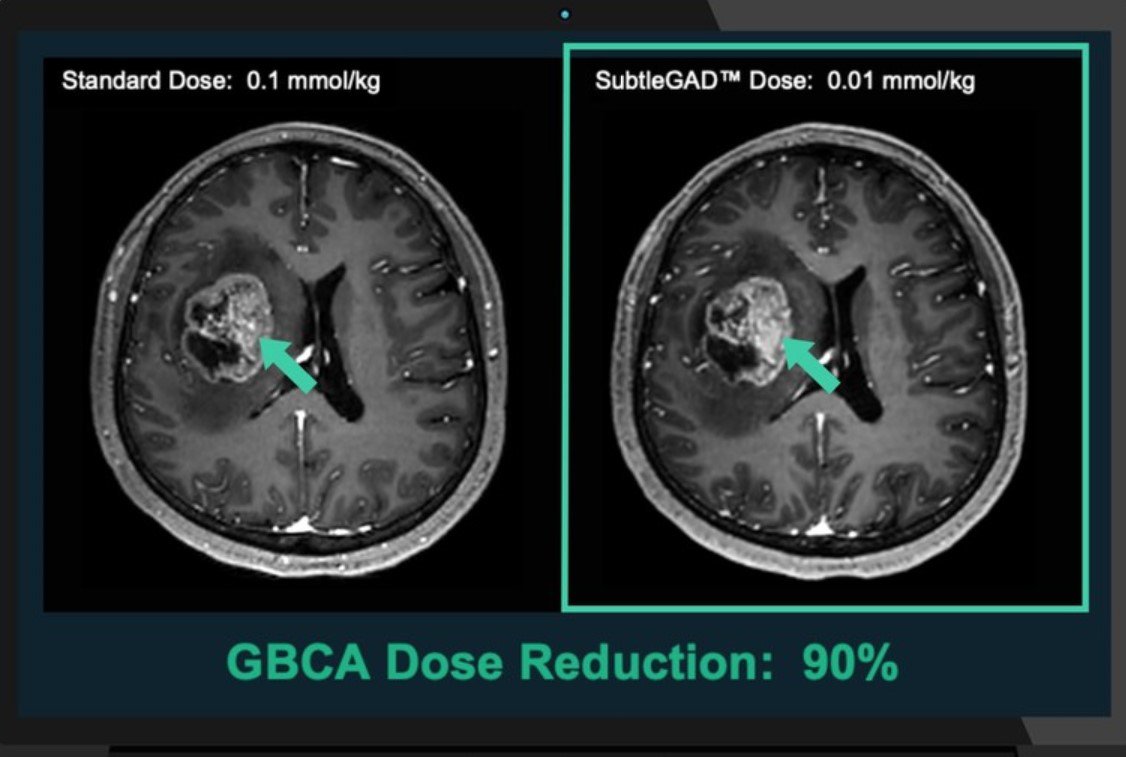 ‌Subtle‌ ‌Medical‌ ‌claims‌ ‌that‌ ‌‌SubtleGAD‌ ‌can‌ ‌reduce‌ ‌gadolinium‌ ‌dosage‌ ‌by‌ ‌90%.‌