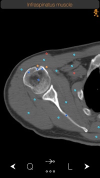 Infraspinatus muscle as shown on CT Anatomy