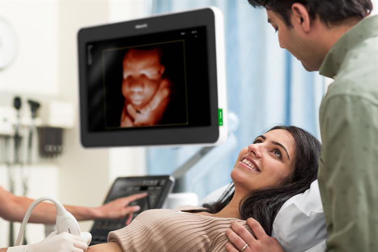 Scanner showing lifelike image of fetus using Philips